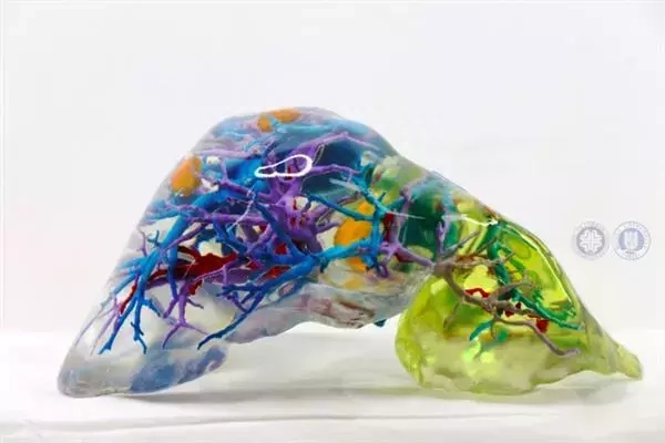 这可能是迄今*为复杂的3D打印肝脏模型!成本超低! - 青岛斯玛特电子科技有限公司